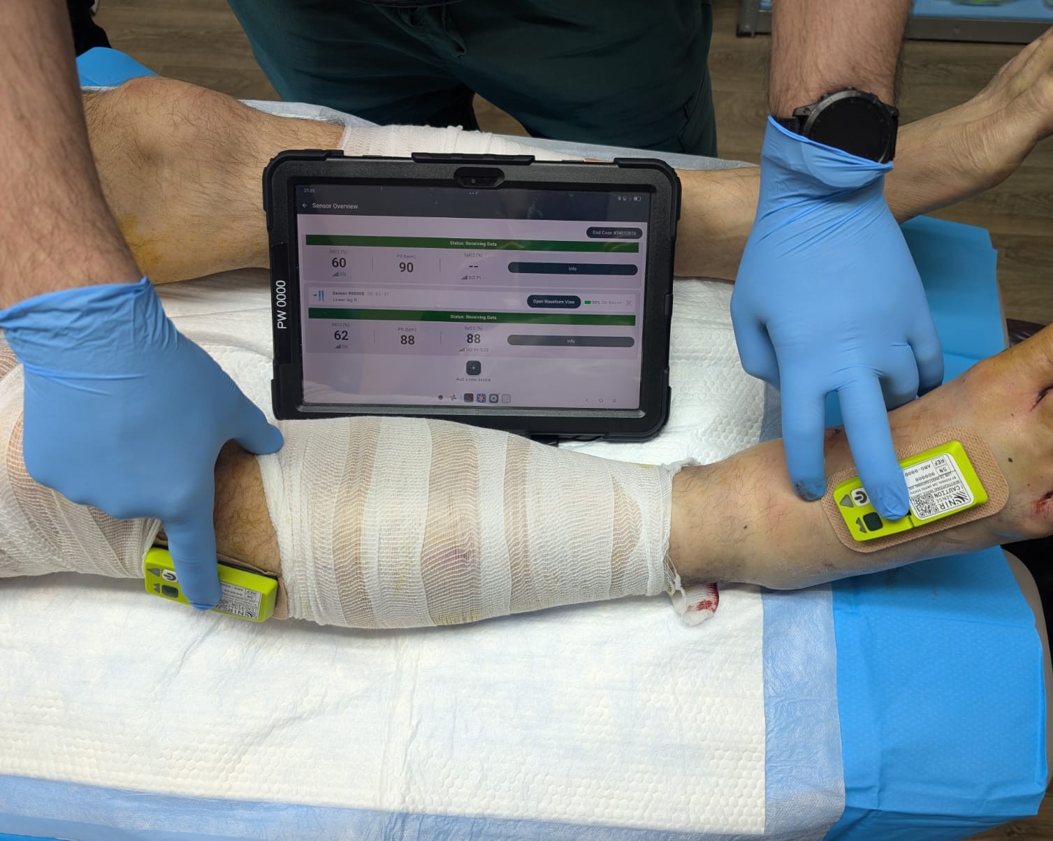 Aspen Medical and NIRSense support Ukrainian defence medics